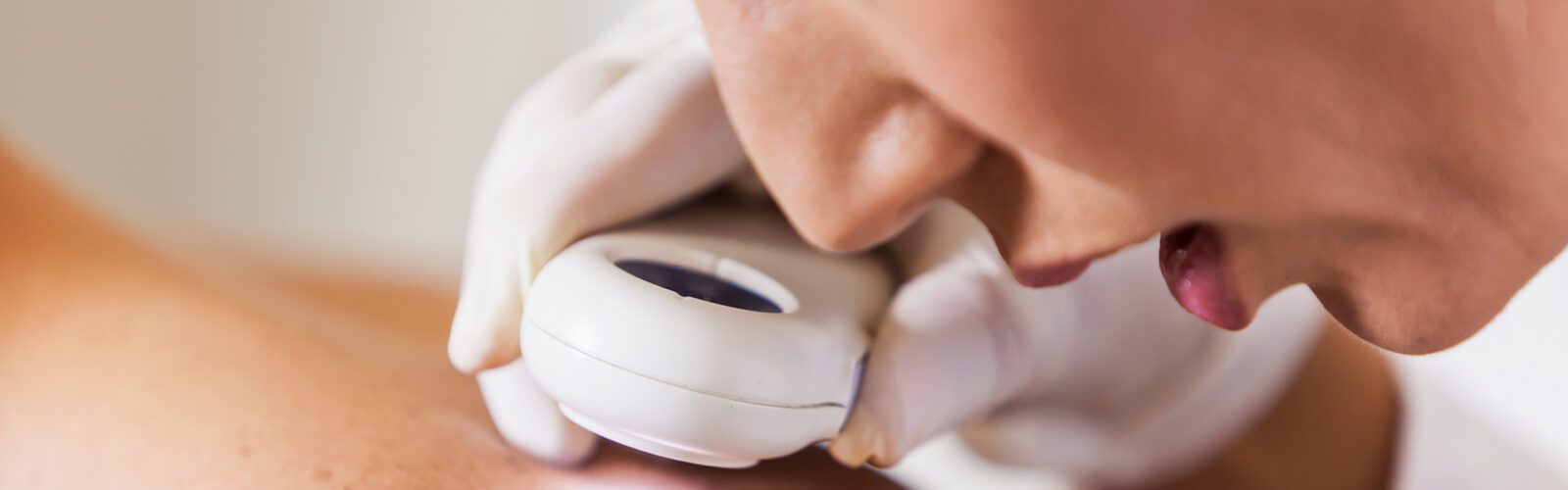 Female dermatologist (30s) examining male patient's skin with dermascope, carefully looking at a mole for signs of skin cancer.